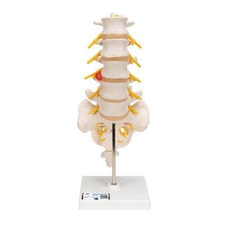 3B SCIENTIFIC Lumbar Spinal Column w. dorso- - w/ 3B Smart Anatomy 1000150